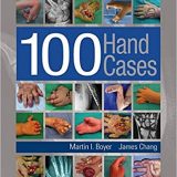 (eBook PDF)100 Hand Cases by Martin Boyer , James Chang