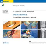 (eBook PDF)AO Manual of Fracture Management - Internal Fixators by Michael Wagner , Robert Frigg