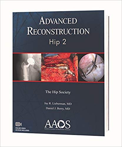 (eBook PDF)Advanced Reconstruction - Hip 2nd Edition (包含VIDEOS) by Jay ...