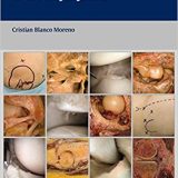 (eBook PDF)Atlas of Arthroscopic Anatomy of the Major joints by Cristian Blanco Moreno
