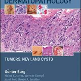(eBook PDF)Atlas of Dermatopathology: Tumors, Nevi, and Cysts by Gunter Burg , Heinz Kutzner , Werner Kempf , Josef Feit , Bruce R. Smoller