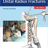 (eBook PDF)Atlas of Distal Radius Fractures (PDF+VIDEOS) by Francisco Del Pinal
