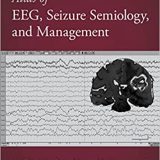 (eBook PDF)Atlas of EEG, Seizure Semiology, and Management 3rd Edition by Bassel Abou-Khalil, Karl Edward Misulis , Hasan Sonmezturk , Kevin C. Ess
