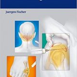 (eBook PDF)Atlas of Injection Therapy in Pain Management by Jürgen Fischer