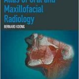 (eBook PDF)Atlas of Oral and Maxillofacial Radiology by Bernard Koong