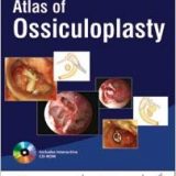 (eBook PDF)Atlas of Ossiculoplasty by Madhuri Mehta