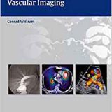 (eBook PDF)Atlas of Pulmonary Vascular Imaging by Conrad Wittram