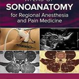 (eBook PDF)Atlas of Sonoanatomy for Regional Anesthesia and Pain Medicine by Manoj Karmakar