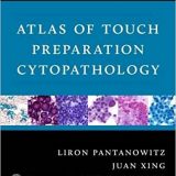 (eBook PDF)Atlas of Touch Preparation Cytopathology 1st Edition by Liron Pantanowitz MD , Juan Xing MD , Sara E. Monaco MD