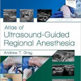 (eBook PDF)Atlas of Ultrasound-Guided Regional Anesthesia 3rd by Andrew T. Gray MD