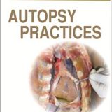 (eBook PDF)Autopsy Practices 2nd Edition by Dhaneshwar Lanjewar
