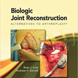 (eBook PDF)Biologic Joint Reconstruction by Dr. Brian Cole MD , Andreas Gomoll MD