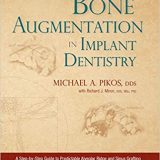 (eBook PDF)Bone Augmentation in Implant Dentistry: A Step-by-Step Guide to Predictable Alveolar Ridge and Sinus Grafting