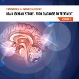(eBook PDF)Brain Ischemic Stroke From Diagnosis to Treatment (Frontiers in Neurosurgery Volume 3) by Simone Peschillo