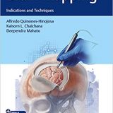 (eBook PDF)Brain Mapping Indications and Techniques PDF+VIDEOS by Alfredo Quinones-Hinojosa , Kaisorn L. Chaichana , Deependra Mahato