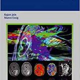 (eBook PDF)Brain Tumor Imaging by Rajan Jain , Marco Essig