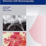 (eBook PDF)Breast Cancer - The Art and Science of Early Detection with Mammography , 1e  by Laszlo Tabar , Tibor Tot , Peter B. Dean