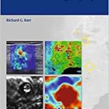 (eBook PDF)Breast Elastography  by Richard G. Barr
