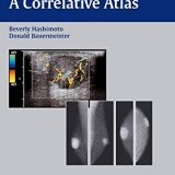 (eBook PDF)Breast Imaging - A Correlative Atlas by Beverly Hashimoto , Donald Bauermeister