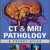 (eBook PDF)CT & MRI Pathology: A Pocket Atlas Third Edition by Michael L Grey, Jagan Mohan Ailinani
