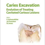 (eBook PDF)Caries Excavation Evolution of Treating Cavitated Carious Lesion by F. Schwendicke , J. Frencken , N. Innes , A. Lussi (Series Editor), M.A.R. Buzalaf (Series Editor)