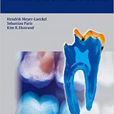 (eBook PDF)Caries Management - Science and Clinical Practice by Hendrik Meyer-Lueckel , Hendrik Meyer-Lückel , Sebastian Paris , Kim Ekstrand