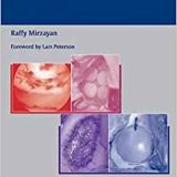 (eBook PDF)Cartilage Injury in the Athlete by Raffy Mirzayan
