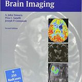 (eBook PDF)Case-Based Brain Imaging, 2nd Edition, 2013 by Apostolos John Tsiouris , Pina C. Sanelli , Joseph Comunale