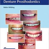 (eBook PDF)Case Guides to Complete and Partial Denture Prosthodontics PDF+VIDEOS by Robin Wilding