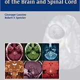 (eBook PDF)Cavernous Malformations of the Brain and Spinal Cord by Giuseppe Lanzino , Robert F. Spetzler