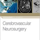 (eBook PDF)Cerebrovascular Neurosurgery (Neurosurgery by Example)