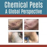 (eBook PDF)Chemical Peels: A Global Perspective 1st Edition by Rashmi Sarkar  , Wendy E Roberts , Sneha Ghunawat , Ishad Aggarwal , Zubin K Mandlewala