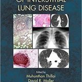(eBook PDF)Clinical Handbook of Interstitial Lung Disease by Muhunthan Thillai , David R. Moller , Keith C. Meyer