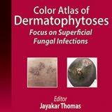 (eBook PDF)Color Atlas of Dermatophytoses Focus on Superficial Fungal Infections by Jayakar Thomas