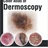 (eBook PDF)Color Atlas of Dermoscopy by Horacio Antonio Cabo Jaypee Brothers Medical Publishers (30 June 2017)