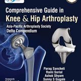 (eBook PDF)Comprehensive Guide In Knee & Hip Arthroplasty by Parag Sancheti