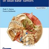 (eBook PDF)Comprehensive Management of Skull Base Tumors 2nd Edition by Ehab Hanna , Franco DeMonte