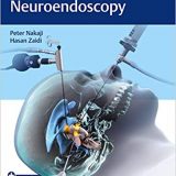 (eBook PDF)Controversies in Neuroendoscopy by Peter Nakaji , Hasan A. Zaidi