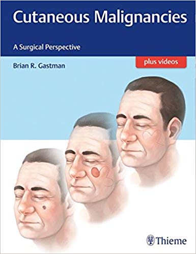 (eBook PDF)Cutaneous Malignancies - A Surgical Perspective by Brian Gastman