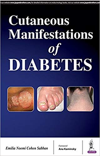 (eBook PDF)Cutaneous Manifestations of Diabetes by Emilia Noemí Cohen Sabban