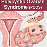 (eBook PDF)Decoding Polycystic Ovarian Syndrome (PCOS) by Kanthi Bansal , Pooja Sharma Dimri