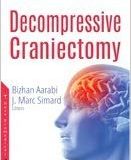 (eBook PDF)Decompressive Craniectomy by Bizhan Aarabi , Marc Simard