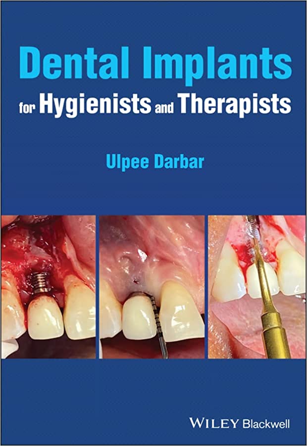 (eBook PDF)Dental Implants for Hygienists and Therapists by Ulpee R. Darbar