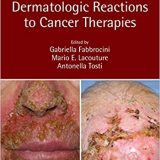 (eBook PDF)Dermatologic Reactions to Cancer Therapies by Gabriella Fabbrocini , Mario E. Lacouture , Antonella Tosti