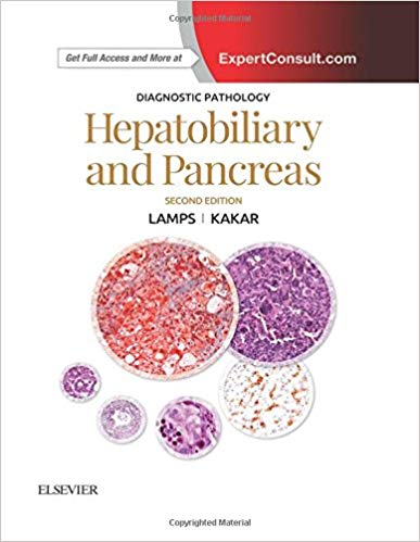 (eBook PDF)Diagnostic Pathology - Hepatobiliary and Pancreas, 2nd Edition by Laura W. Lamps MD , Sanjay Kakar MD