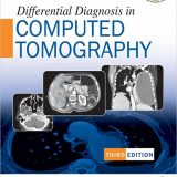 (eBook PDF)Differential Diagnosis in Computed Tomography 3rd Edition by Sumeet Bhargava , Satish K Bhargava