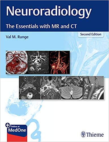(eBook PDF)Neuroradiology The Essentials with MR and CT, 2nd Edition by ...