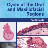 (eBook PDF)Shear s Cysts of the Oral and Maxillofacial Regions 5th Edition by Paul M. Speight