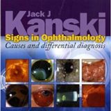 (eBook PDF)Signs in Ophthalmology - Causes and differential diagnosis by Jack J. Kanski MD MS FRCS FRCOphth