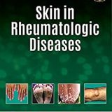 (eBook PDF)Skin In Rheumatologic Diseases 1st edition by Savita Yadav